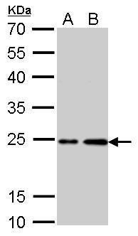 H-Ras Rabbit Polyclonal Antibody