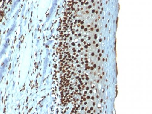 H1-0, N/A Antibody