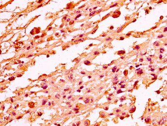 H1F0 Antibody