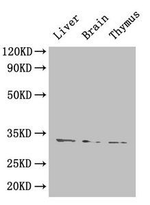 HAVCR1 Antibody