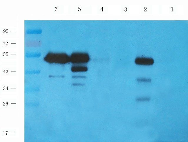 HAVCR2 Rabbit Polyclonal Antibody