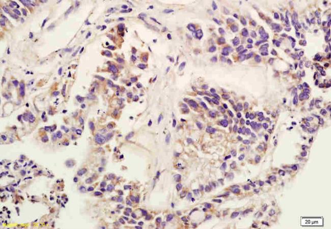 HBEGF Rabbit Polyclonal Antibody