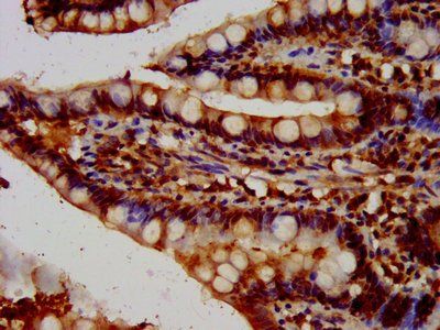 HBEGF Antibody