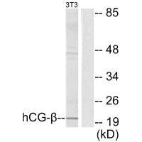 CGB Antibody