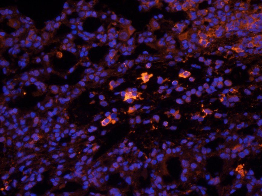 HDAC2 Rabbit Polyclonal Antibody