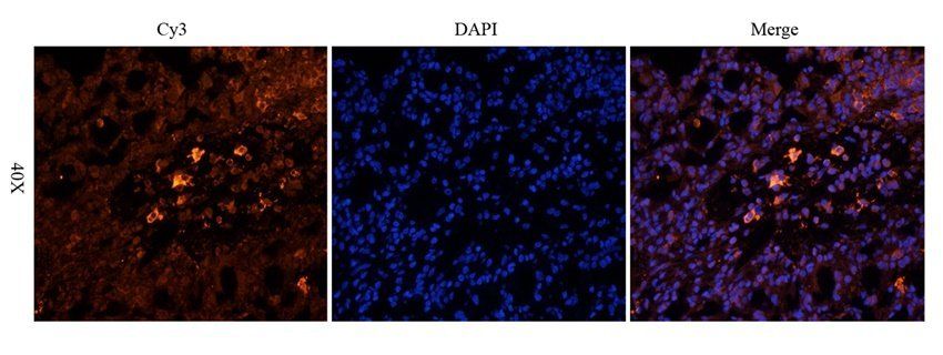 HDAC2 Rabbit Polyclonal Antibody