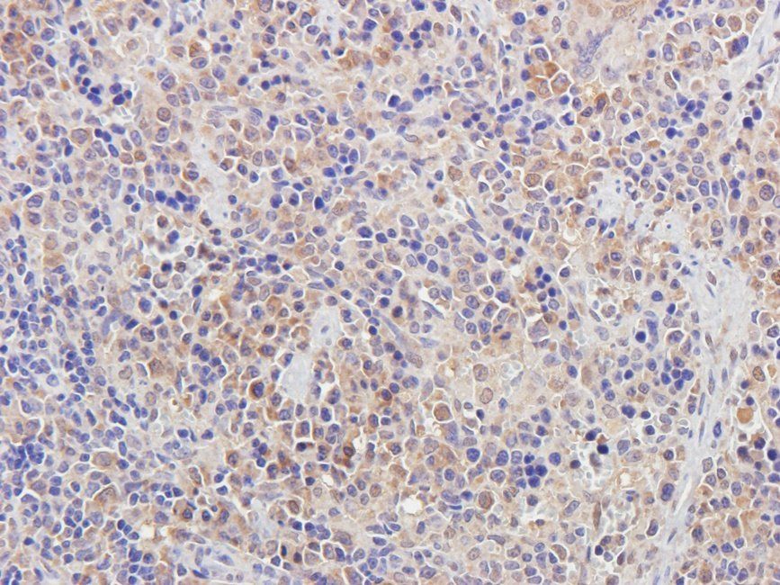 HDAC2 Rabbit Polyclonal Antibody