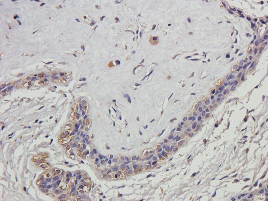 HDAC2 Rabbit Polyclonal Antibody