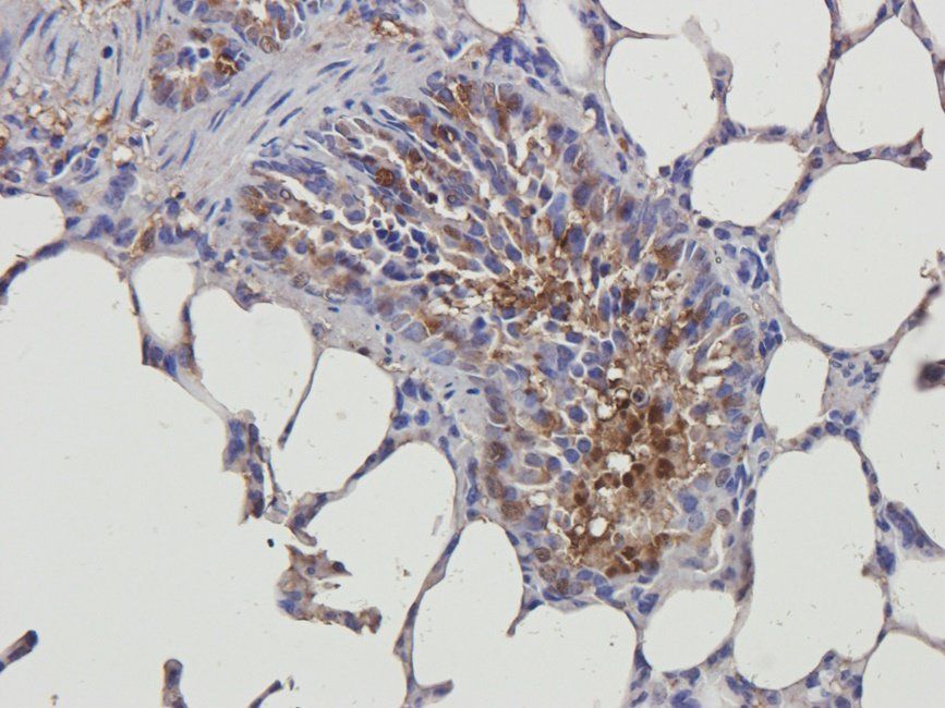 HDAC2 Rabbit Polyclonal Antibody
