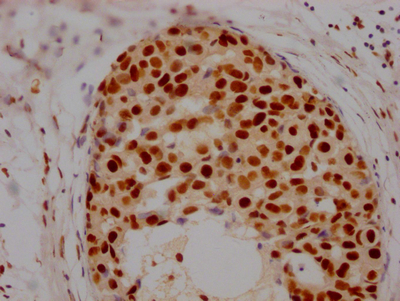 HDAC2 Antibody