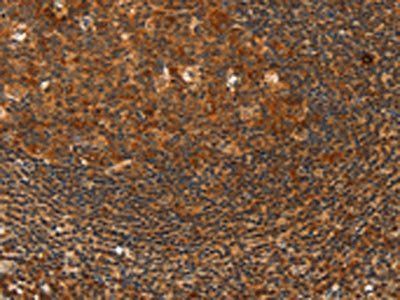 HDAC8 Antibody