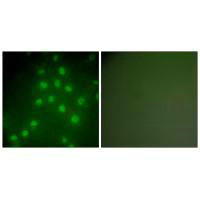 HDAC9 Antibody