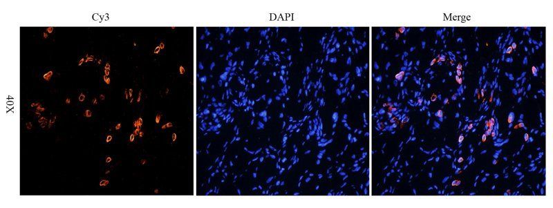 HE4 Rabbit Polyclonal Antibody