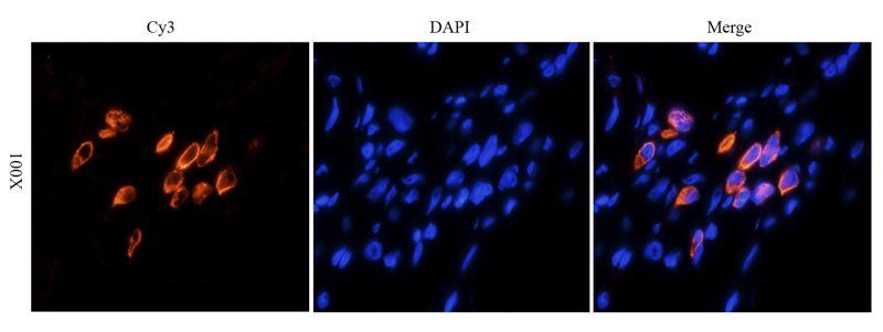 HE4 Rabbit Polyclonal Antibody