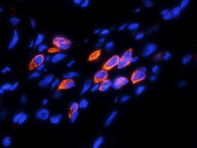 HE4 Rabbit Polyclonal Antibody