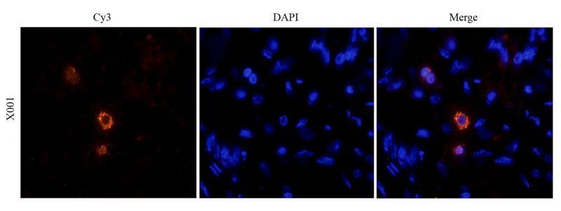 HE4 Rabbit Polyclonal Antibody