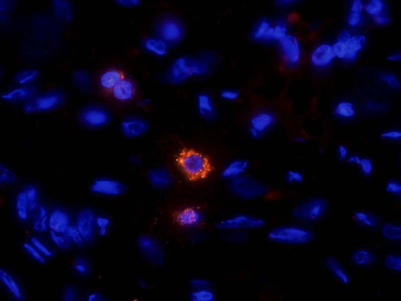 HE4 Rabbit Polyclonal Antibody
