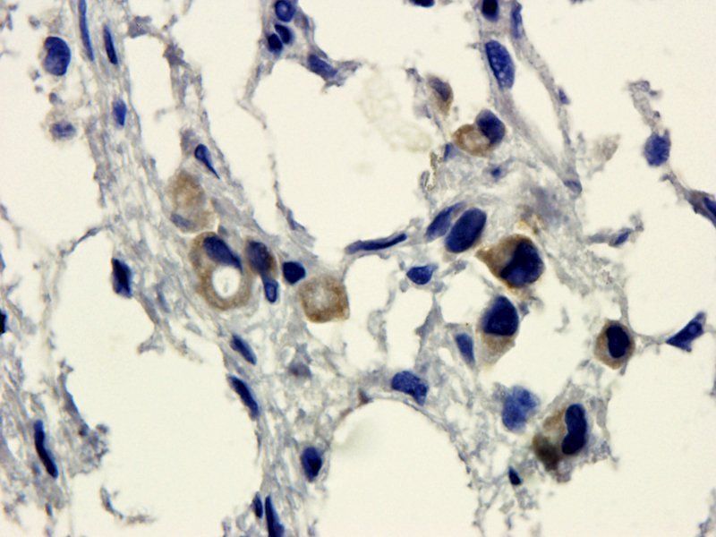 HE4 Rabbit Polyclonal Antibody
