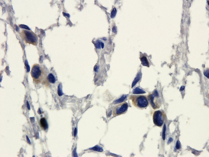 HE4 Rabbit Polyclonal Antibody