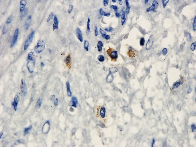 HE4 Rabbit Polyclonal Antibody