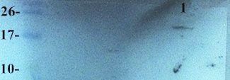 HE4 Rabbit Polyclonal Antibody