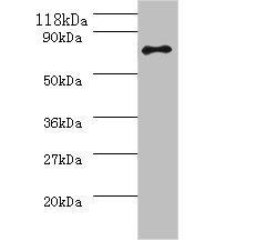 ureB Antibody