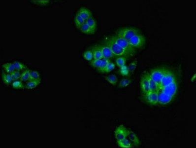 HAVCR2 Antibody