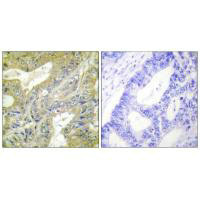 HEXB Antibody