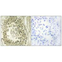 HGS Antibody