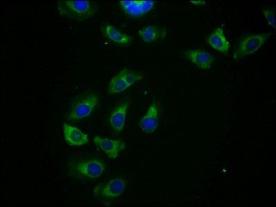 HHLA2 Antibody