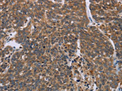 HIF1AN Antibody