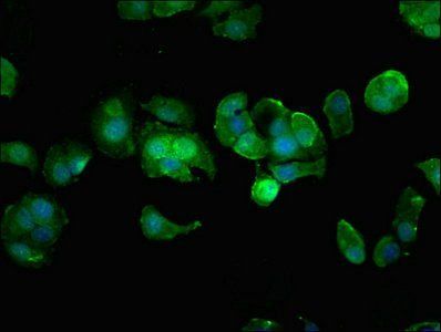 HIPK3 Antibody