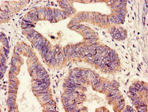 HIPK3 Antibody