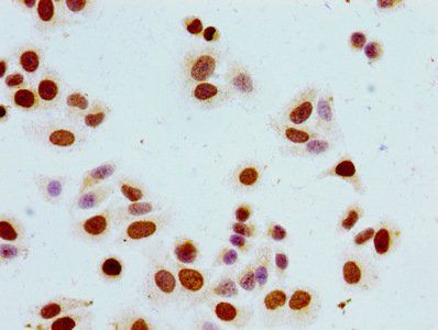 HIST1H1B Antibody