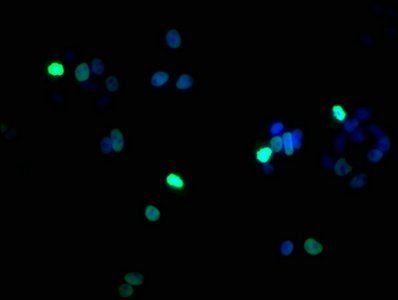 HIST1H1B Antibody