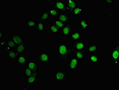 HIST1H2AG Antibody