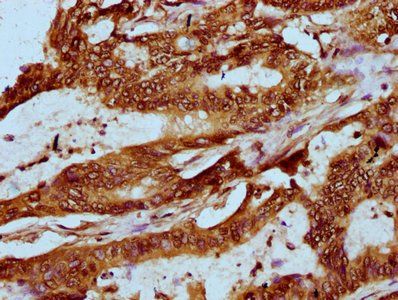 HIST1H2AG Antibody