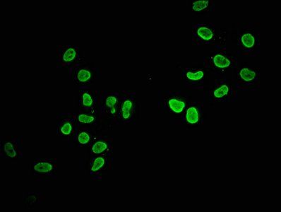 HIST1H2AG Antibody
