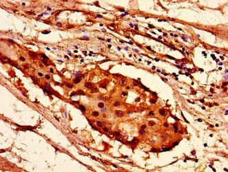 HIST1H2AG Antibody