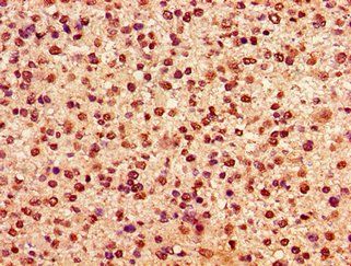 HIST1H2AG Antibody