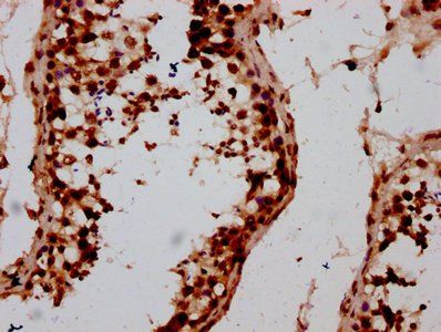 HIST1H2AG Antibody