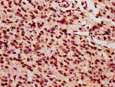 HIST1H2AG Antibody