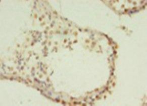HIST1H2AG Antibody