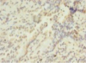 HIST1H2AG Antibody