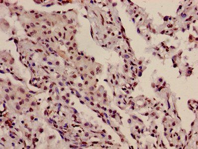 HIST1H3A Antibody