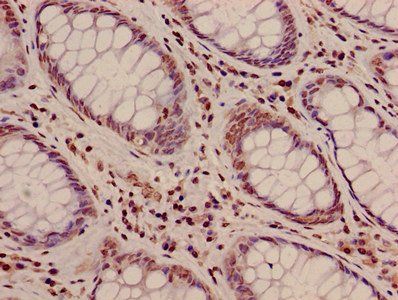 HIST1H3A Antibody