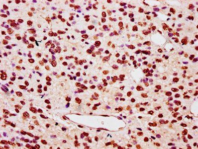 HIST1H3A Antibody