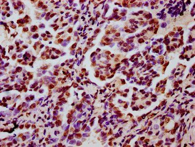 HIST1H3A Antibody