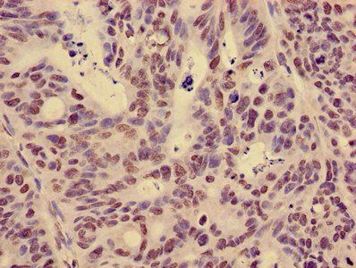HIST1H3A Antibody
