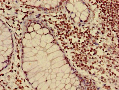 HIST1H3A Antibody